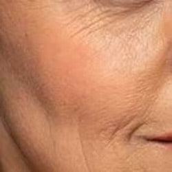 Aging